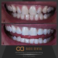 Oasis Dental Studio - Palm Beach image 1